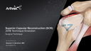 Superior Capsular Reconstruction (SCR): 2018 Technique Evolution