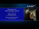 Univers™ II, Pegged Glenoid Surgical Technique