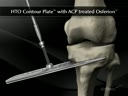 ContourLock HTO Plate® with ACP treated OSferion™