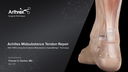 Achilles Midsubstance Tendon Repair With PARS Using the Knotless Midsubstance SpeedBridge™ Technique