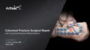 Calcaneal Fracture Surgical Repair with Calcaneal Fracture Plating System