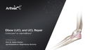 Elbow LUCL and UCL Repair - Corkscrew® vs. InternalBrace™